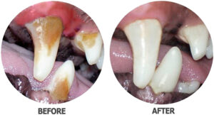 Canine teeth before and after treatment