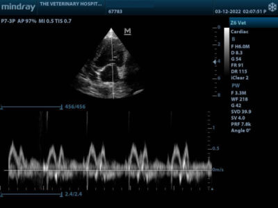 Heart Ultrasound